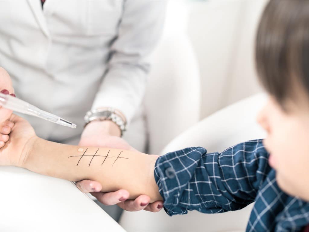 Así son las pruebas para detectar la alergia en tus hijos.